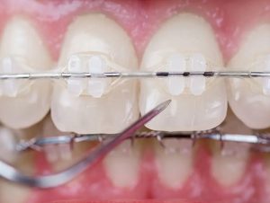 mauvezin brackets zafiro