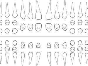 mauvezin diagnosis periodoncia
