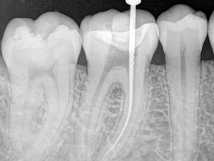 mauvezín odontología
