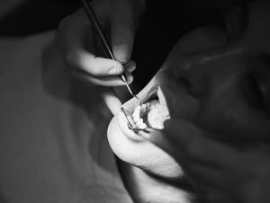 mauvezin mantenimineto 